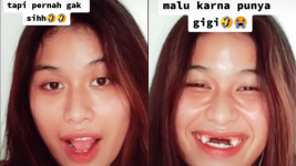 Viral Pesona Widya Ulfa, Seleb TikTok Gigi Ompong yang Parasnya Cantik Banget!