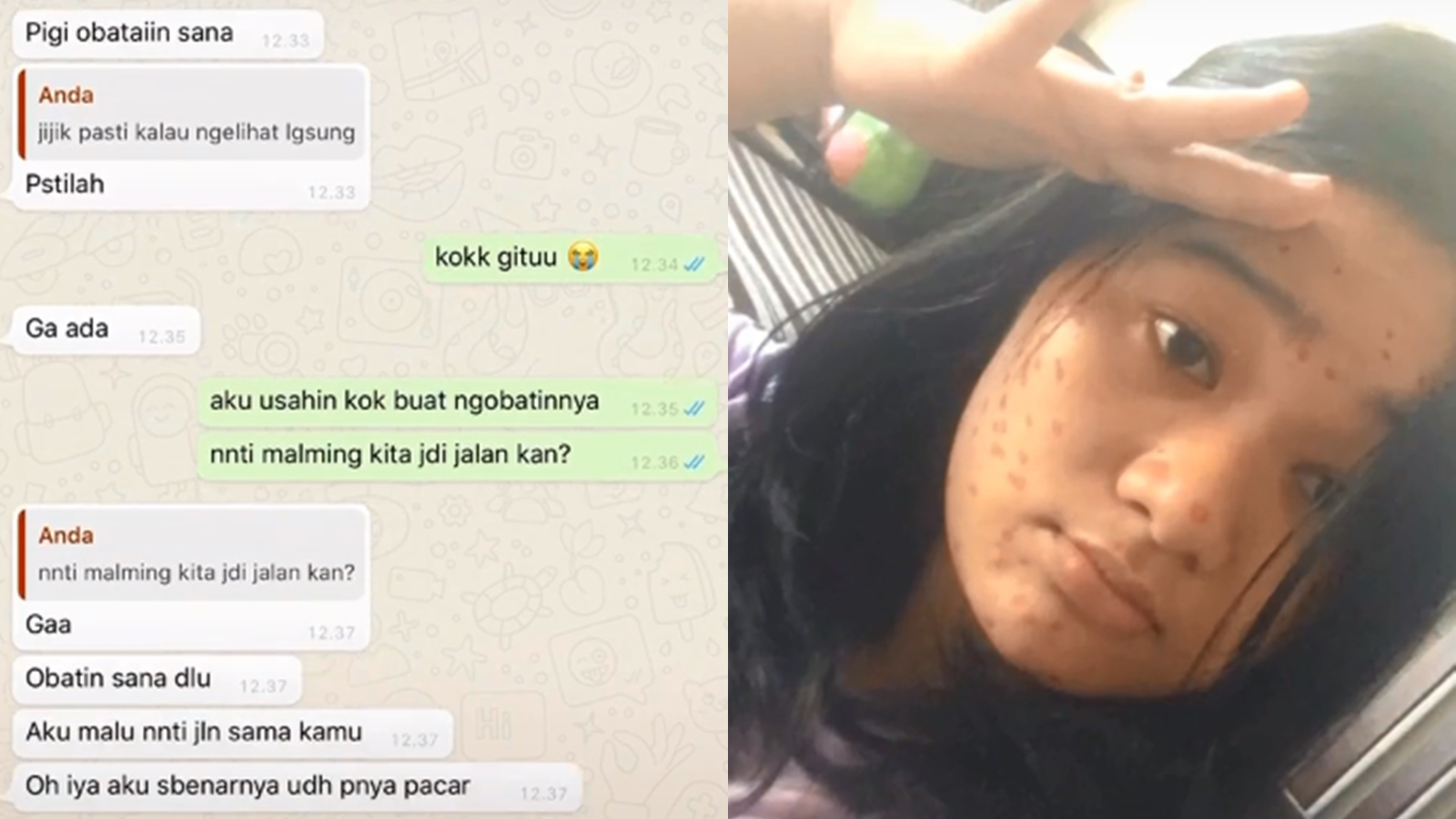 Viral Prank Filter Bikin Wajah Berjerawat, Wanita Ini  Auto di Blokir Gebetannya