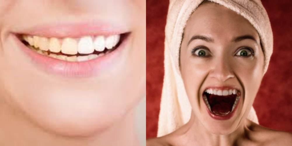 8 Cara alami Merawat Kesehatan Gigi Agar Selalu Putih, Simak Gaes
