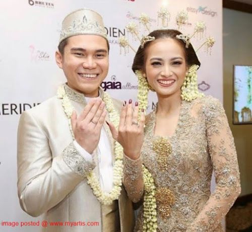Berakhir Setelah 8 Tahun, Acha Septriasa dan Vicky Kharisma Resmi Cerai