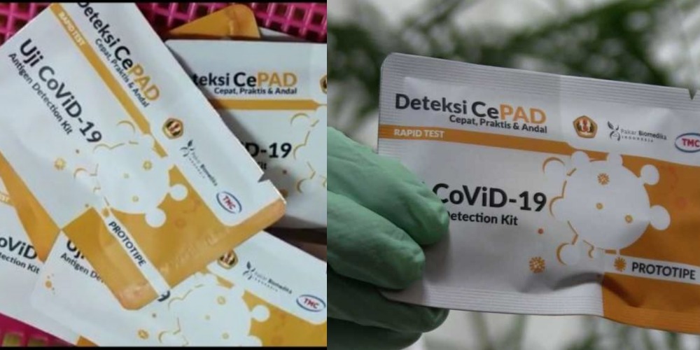 Gak Cuma UGM, UNPAD Juga Punya Rapid Test Antigen CePAD, Simak Faktanya Nih