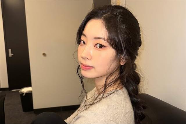 Dahyun TWICE Absen dari Tur Amerika Utara karena Cedera Ankle