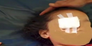 Fakta dan Profil AP, Gadis 6 Tahun Korban Pesugihan yang Dicongkel Matanya