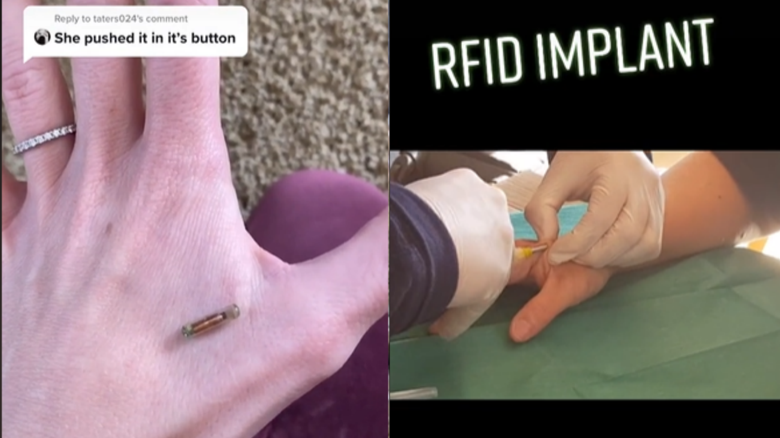Fakta-fakta RFID Chip yang Viral di TikTok, Warga AS Pamer hingga FYP Gaes!