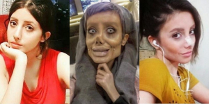 8 Foto Sahar Tabar Sebelum Operasi Plastik, Cantik Menawan Gaes Bukan Mirip Zombie