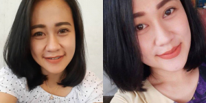 Fakta dan Profil Eva Sofiana Wijayanti, Perawat Cantik yang Dibakar Dengan Pertalite di Wajah Gaes