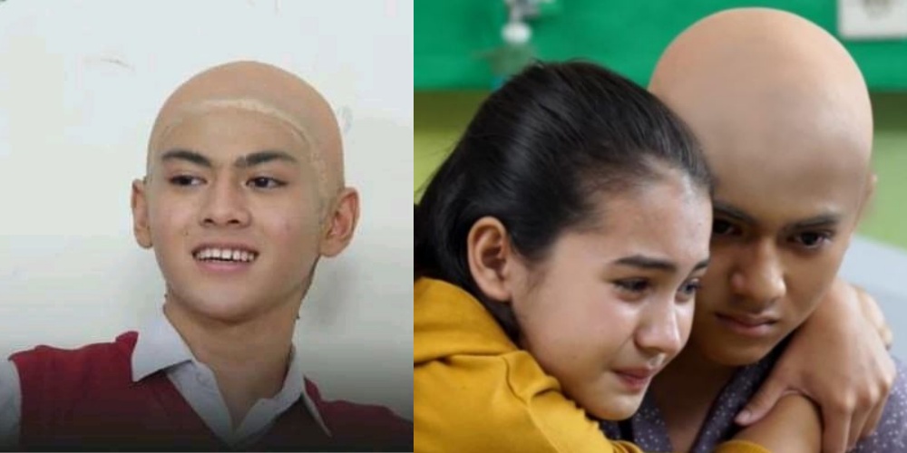 Kumpulan Foto Asli Rey Bong Rambut Botak di Sinetron Dari Jendela SMP, Bikin Haru Lho