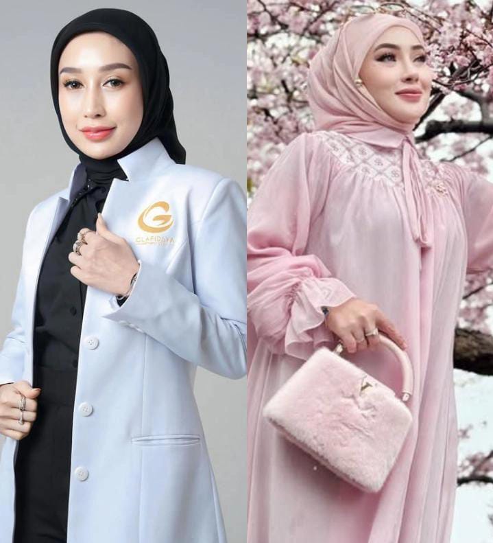 Terseret Daftar Kosmetik Berbahaya BPOM, Ini Klarifikasi Reza Gladys dan Shella Saukia