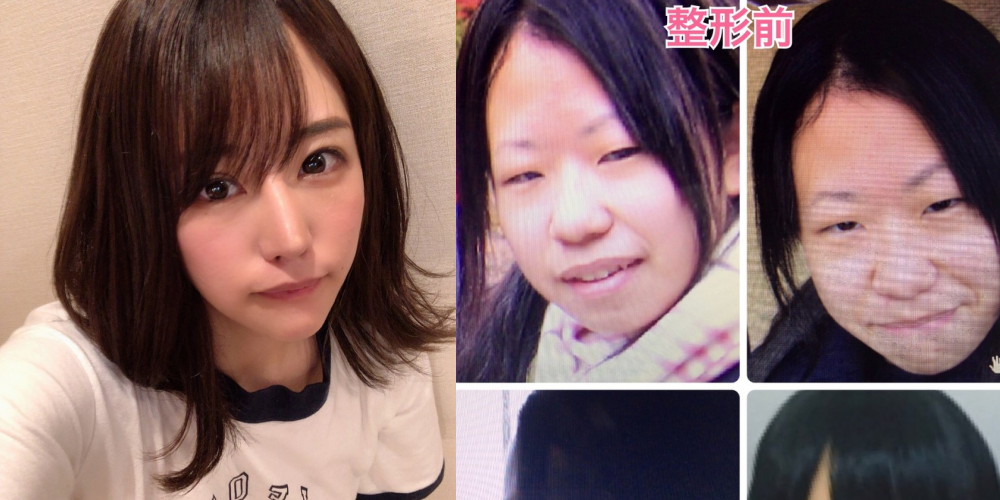 Foto Transformasi Oplas Gadis Jepang ini Bikin Netizen Heboh Gaes! Bedanya Jauh Banget