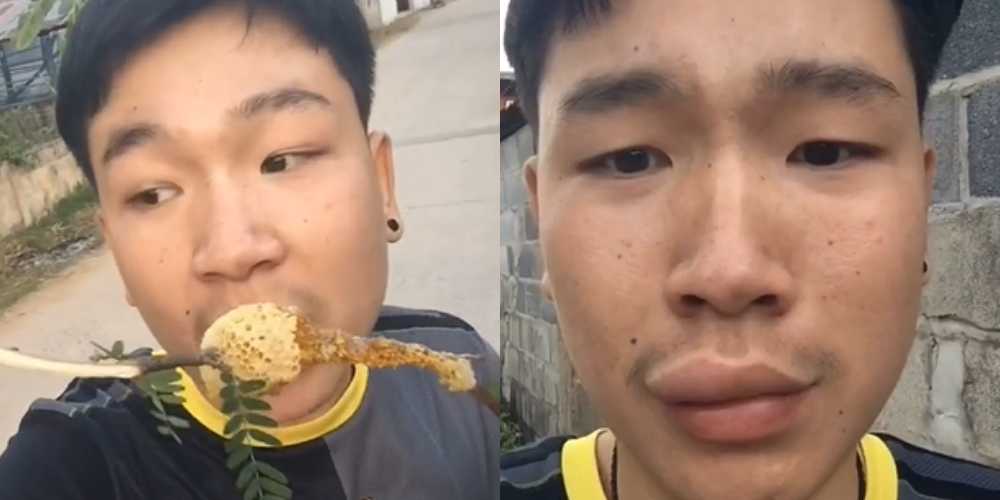 Viral Bibir Cowok Ini Bengkak Usai Makan Madu Dari Sarang Lebah, Netizen Auto Ngakak 