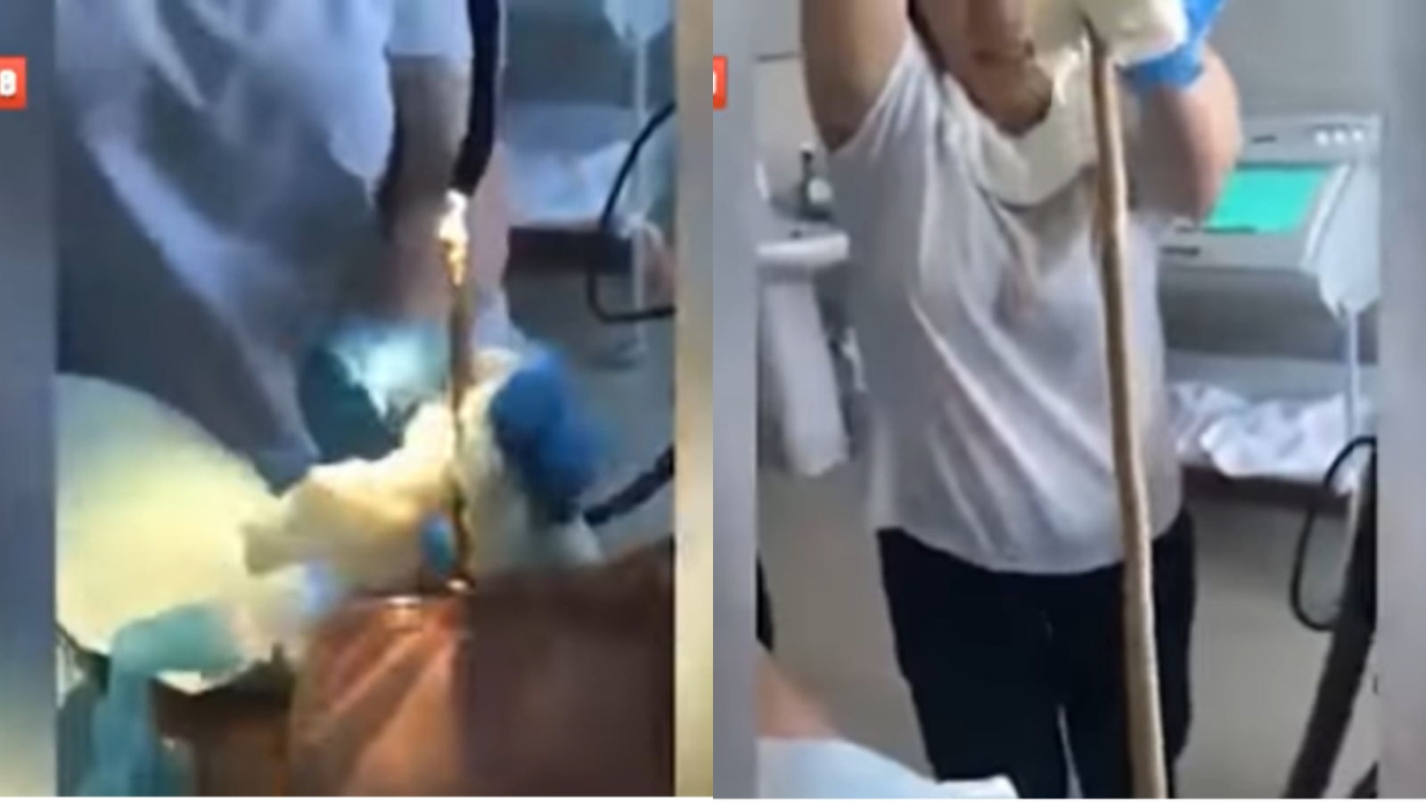 Viral Video Dokter Keluarkan Ular dari Mulut Pasien, Tertelan?